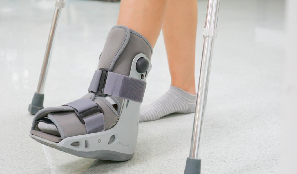 Tipos de botas ortopédicas Walker para fracturas de pie y tobillo